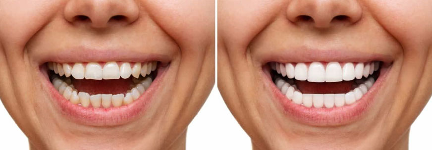 Premier Dentist in Abu Dhabi