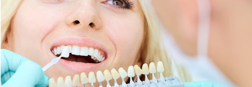 Dental Gap Filling Treatment in Abu Dhabi