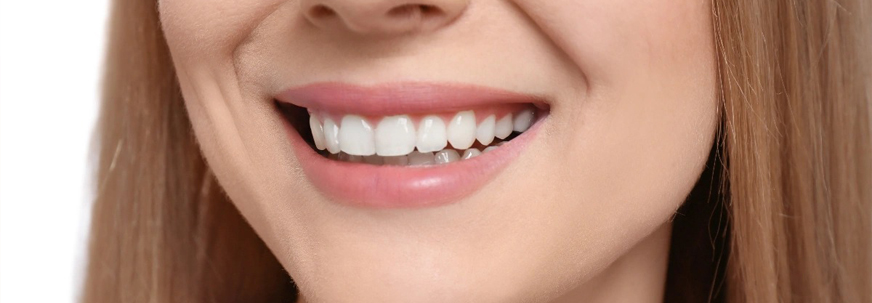 Hollywood Smile Design in Abu Dhabi