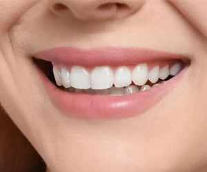 Tooth Filling